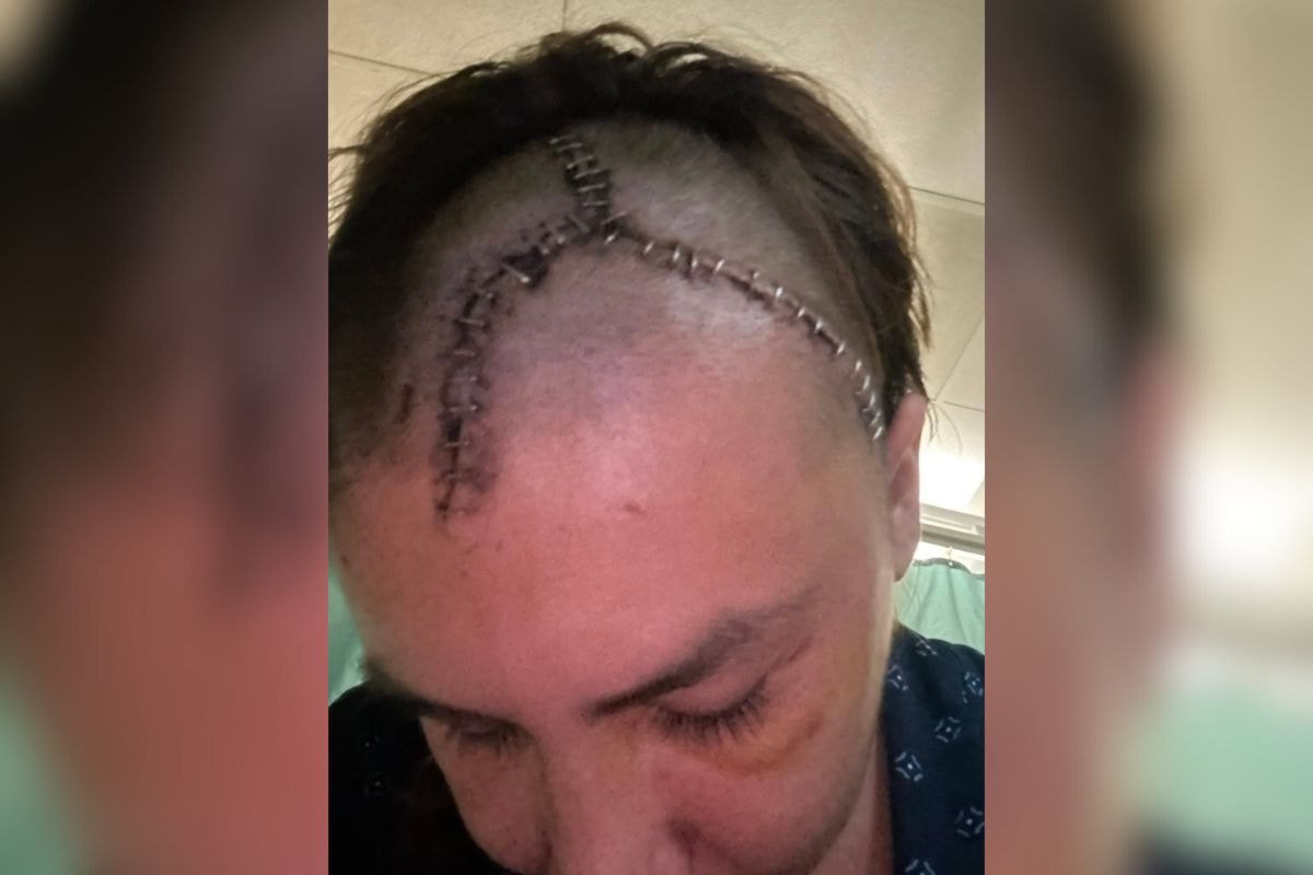 Vernon beach party raising funds for injured woman