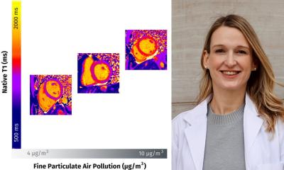 How air pollution may damage the heart • healthcare-in-europe.com