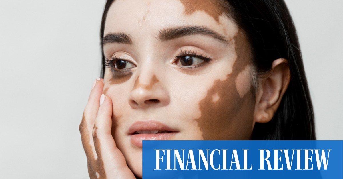 Avita serves up a $23m capital raise but goes shy with co-manager