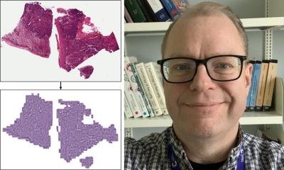 a boost for digital pathology • healthcare-in-europe.com