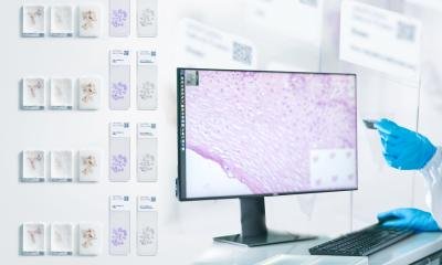 New global partnership addresses digital pathology workflow • healthcare-in-europe.com