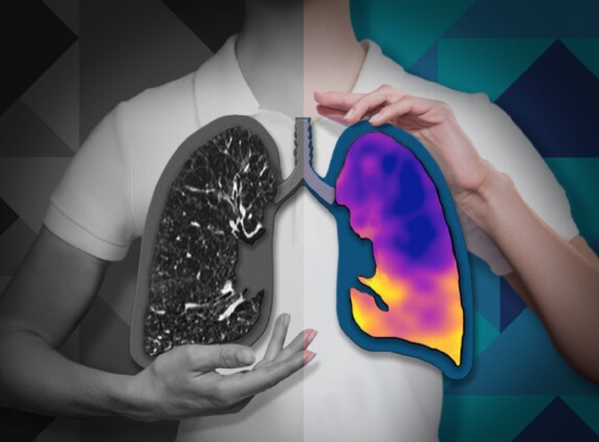 Australian startup 4DMedical receives CE Mark to launch respiratory imaging technology in Europe
