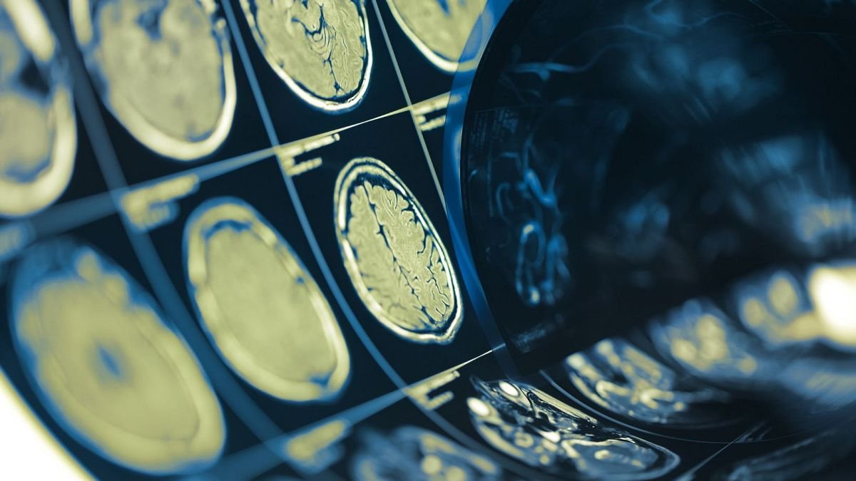 A brain-computer chip can read people's minds with up to 74% accuracy