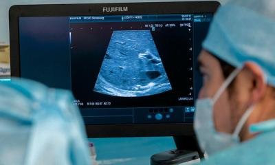 Ultrasound and 3D planning to enhance surgical training • healthcare-in-europe.com