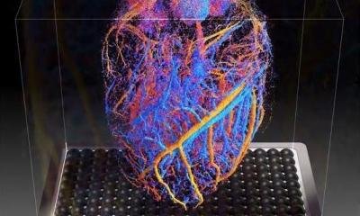 4D blood flow imaging of whole organs • healthcare-in-europe.com